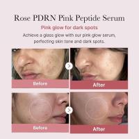 Medicube PDRN Pink Peptide Serum Hidratante, Reafirmante, Desigualdad del tono de la piel - details 0